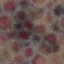 c4501_Blister_a_l.png
