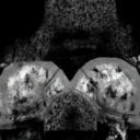 HD_F_8010_L_s.png